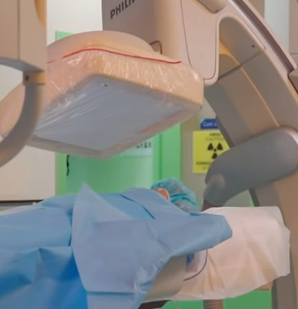 Comment Se Debarrasser Dune Infection Du Tube Digestif
